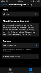 Über 7 millionen englischsprachige bücher. Apple Watch Series 5 Ecg App Not Show Or Apple Community