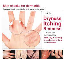 Coronavirus | Preventing Dermatitis
