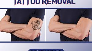Working in non laser tattoo removal is a unique, modern and fun profession and can be a base or appendix as another option in your workplace, its more suitable for tattoos designers and permanent makeup fit for those with a background in skin care or health and cosmetics or salons. Non Laser Tattoo Removal The Most Easy And Cost Effective Way To Remove Tattoo Whatech