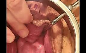 Vídeo em 4k e hd pronto para edição não linear imediata. Filthy Gyno Doctor Performs Cute Teen Exam Xxx O5