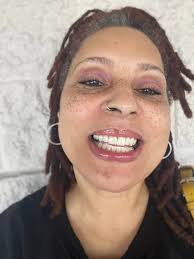 Teeth Whitening Results with The Smile Mission in St. Petersburg, Florida