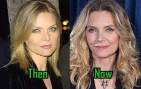 Celebrity plastic surgery michelle pfeiffer. Michelle Pfeiffer Plastic Surgery Creates Age Defying Face Before After Celebritysurgeryicon