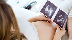 Ab wann kann man das geschlecht erkennen? Ultraschall 20 Ssw Was Erfahre Ich Bei Der Grossen Halbzeit Untersuchung Mibaby Magazin Ratgeber Testberichte Fur Eltern