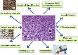 Find out more about malignant soft tissue tumors at cleveland clinic. Biological Characteristics Of Malignant Cells A Histology Of Human Download Scientific Diagram