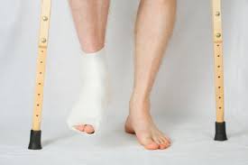 Hallux Valgus Op So Bereiten Sie Sich Richtig Vor
