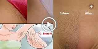 Electrolysis is considered a permanent hair removal method since it destroys the. If You Want To Remove Pubic Hair Permanently Then Try This Simple Home Method Style Hunt World