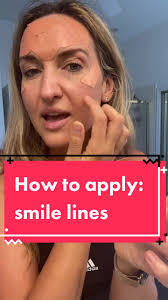 How to Apply Frownies Around Mouth: Smile Line Prevention Tutorial