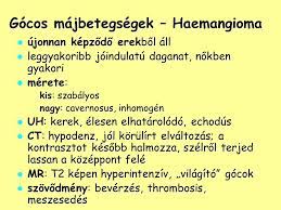 Maj Es Az Eperendszer Betegsegei Ppt Letolteni