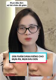 Sản phẩm trị mụn ẩn và đầu đen hiệu quả