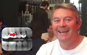 Waterlooville man awarded £7,000 in compensation after dental nightmare