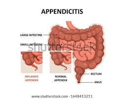 Appendix Drawing At Getdrawings Free Download
