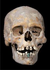 History of dental biomaterials: biocompatibility, durability and still open  challenges