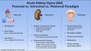 Image result for Postrenal Failure