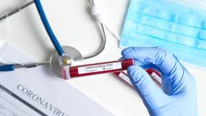 Bu test özellikle pandemi döneminde; Covid Antikor Test Nedir Pcr Test Nedir Aralarinda Ne Fark Vardir Sagliga Acilan Kapiniz