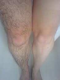 Seriously 1tbsp Of Iodine 2 And 1cup Of Baby Oil Rub Your Hairy Area With The Mixture And Let Set For Only 5 Beauty Hacks Health And Beauty Tips Beauty Care