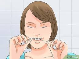 Teeth whitening kits have been around for decades. 3 Ways To Whiten Your Teeth When You Have Braces Wikihow