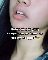 Gigi tonggos dikenal juga dengan istilah overbite atau maloklusi. Netizen Maha Benar On Instagram Wee Dasar Netyzenn Instagram Wee Humor