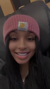 How my veneers look….Colombia 🇨🇴