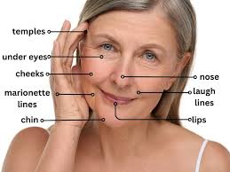 Filler Injection With Natural Results Singapore