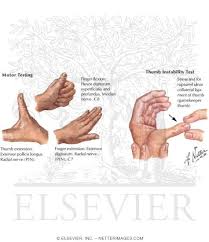Image result for Hand Exam