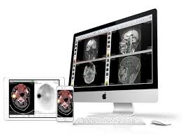 Check spelling or type a new query. Osirix Dicom Viewer The World Famous Medical Imaging Viewer