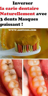 Inverser La Carie Dentaire Naturellement Avec 3 Dents Masques Puissant Herbal Medicine Herbalism Food