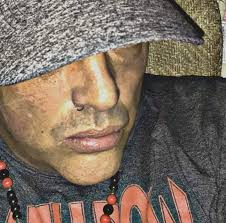 Lynchburg needs more wildlife.