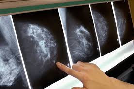 What breast cancer treatments can cause menopausal symptoms? Hormone Therapy During Menopause Raises Breast Cancer Risk For Years Scientific American