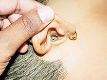 This video is about how to use ear drops getting ear drops into your ear canal may seem straightforward, but there are a few. Earwax Wikipedia