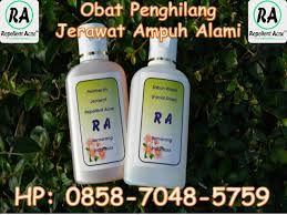 Callusol dikemas dalam bentuk cairan obat luar yang dijual secara bebas. Obat Jerawat Untuk Ibu Hamil Pria Punggung 0858 7048 5759