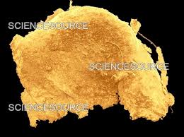 Image result for Rheum