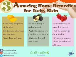 Home Remedies For Itchy Skin Home Remedies Remedies Itchy Skin