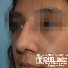 DHR Health Plastic & Reconstructive Surgery Institute (@dhrhealthplastics)  • Instagram photos and videos