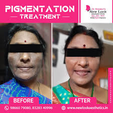 Dr.Sreedevi's New Look Aesthetic Clinic