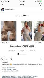 At mia aesthetics we provide the highest quality plastic surgery, all at affordable prices. My Bbl Journey My Doctor Is Going To Be Ghassan Mehio From Mia