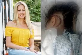 Where do multiple hereditary exostoses most commonly occur? This Teen S Sore Throat Turned Out To Be A Brain Tumor