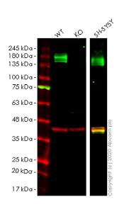 We did not find results for: Anti Calcium Pump Pmca4 Atpase Antibody Ja9 Ko Tested Ab2783 Abcam