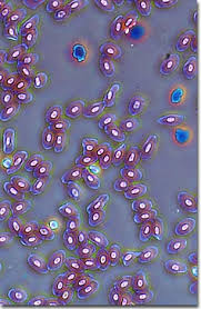The biggest difference between an immature rbc and a mature one is that the immature rbc still has a nucleus, and a rbc of all the mammals is anucleated without any exception. Molecular Expressions Microscopy Primer Specialized Microscopy Techniques Phase Contrast Photomicrography Gallery Amphibian Red Blood Cells