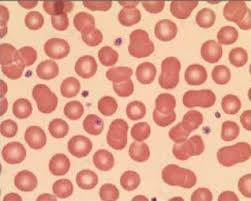 Gambar 2.1 komponen darah a. Pengertian Plasma Darah Fungsi Ciri Komponen Dan Susunan