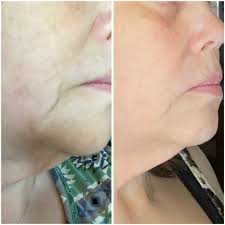 New Youth Ageless Sculpting Wands 6-Day Results and Product Routine