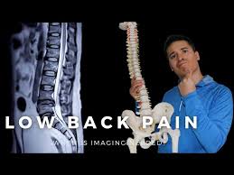 Image result for Low Back Imaging