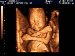 Fetal Ultrasound Training Phantoms Cirs