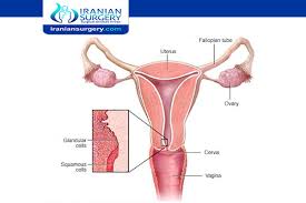 Stages l through lv (1 through 4). Cervical Cancer Causes Pre Cancerous Cervical Abnormalities
