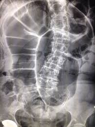 Pin On Radiology