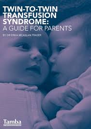 Twin-To-Twin Transfusion syndrome: A GUIDE FOR pAREnts