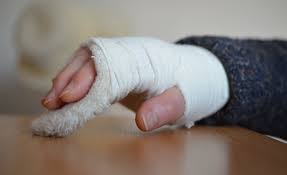 Image result for Hand Fracture