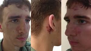 I thought he was going to kill me': Soldier suffers traumatic brain injury  following hazing incident during training