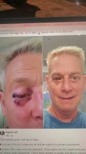 When I shared this post from my friend, David Call, FB was quick to let me  know they might be taking it down. But I think it is important that we  don't hide hate crimes and address them out loud and ...