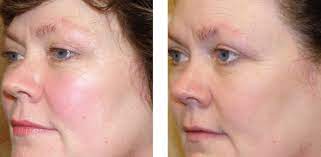 We did not find results for: Obraji Rosii Care Ard Despre ViaÈa Din Romania