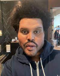 The weeknd performs at the super bowl lv pepsi halftime show. Besuch Beim Beauty Doc The Weeknd Schockt Mit Neuem Look Promiflash De